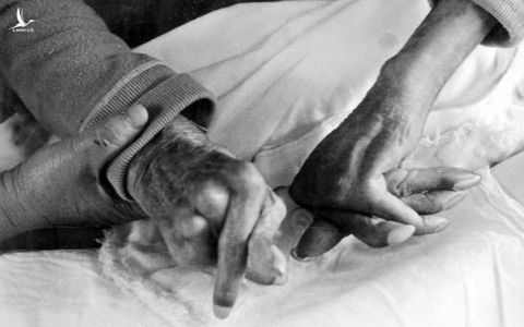 Hình ảnh bệnh nhân bị bệnh Minamata không thể co duỗi tay. Ảnh chụp năm 1970 và được đăng trên báo Mainichi 