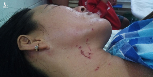 Vụ chồng đánh đập vợ từ dưới nước lên tận bờ ở Tây Ninh: Lời kể cay đắng của người vợ - Ảnh 1