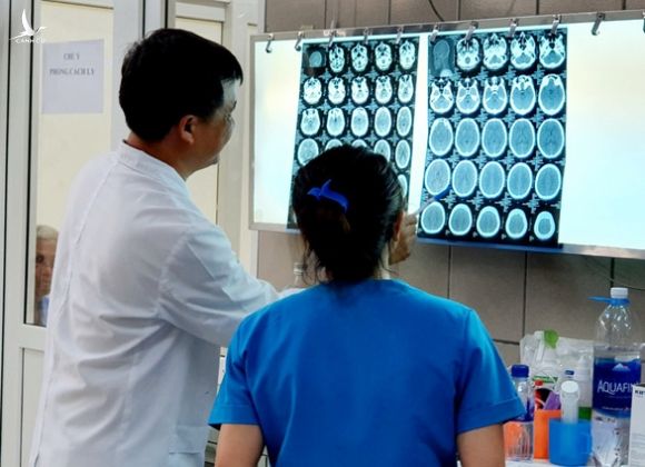Lần đầu tiên ở Việt Nam có bệnh nhân xuất huyết não do... ngộ độc ma túy đá - Ảnh 1.