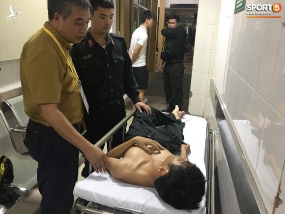 Sau fan nữ trúng pháo, một cảnh sát cơ động nhập viện vì xô xát ở khu vực khán đài CĐV Nam Định - Ảnh 1.
