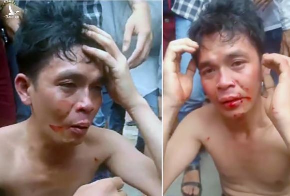 Kích động vụ cha đánh con, Facebook Đàm Vĩnh Hưng có thể bị xử hình sự