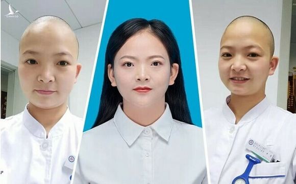 HÌnh ảnh nữ y tá trước và sau khi cạo trọc đầu. Ảnh: China Daily