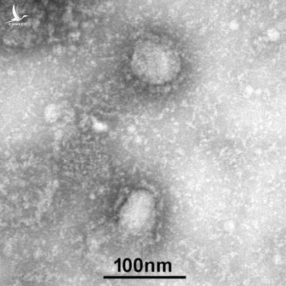 Trung Quốc công bố hình ảnh chính thức của virus corona