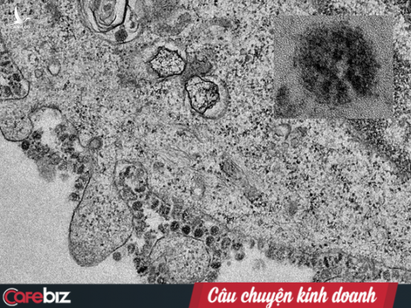 Bác sĩ BV Chợ Rẫy giải đáp về Virus corona: Lây nhiễm theo cơ chế nào? Qua đường không khí hay đường ăn uống? Vì sao gia đình 3 người Trung Quốc cùng sang Việt Nam mà chỉ 2 cha con nhiễm, còn người mẹ thì không? - Ảnh 2.