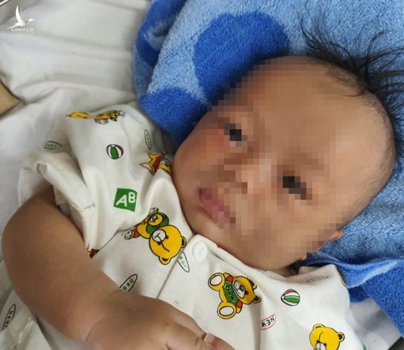 Con trai 4 tháng tuổi nghi bị cha ruột ‘chơi đá’ đánh đến xuất huyết não, gãy chân - ảnh 1
