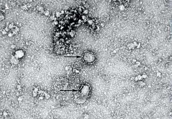 Hình ảnh vi rút corona mới trên kính hiển vi /// CCDC