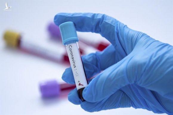 Mỹ sử dụng kit xét nghiệm virus corona cho kết quả sau 45 phút - 1