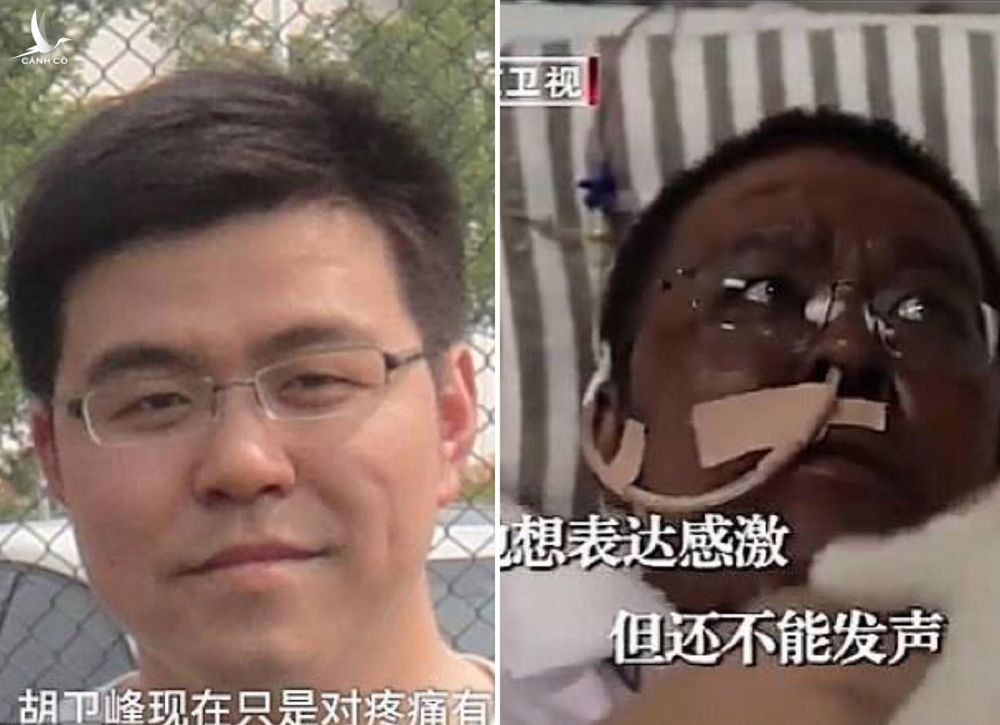 Bác sĩ Hu trước và sau khi nhiễm nCoV. Ảnh: Pear Video, Beịing Satellite TV