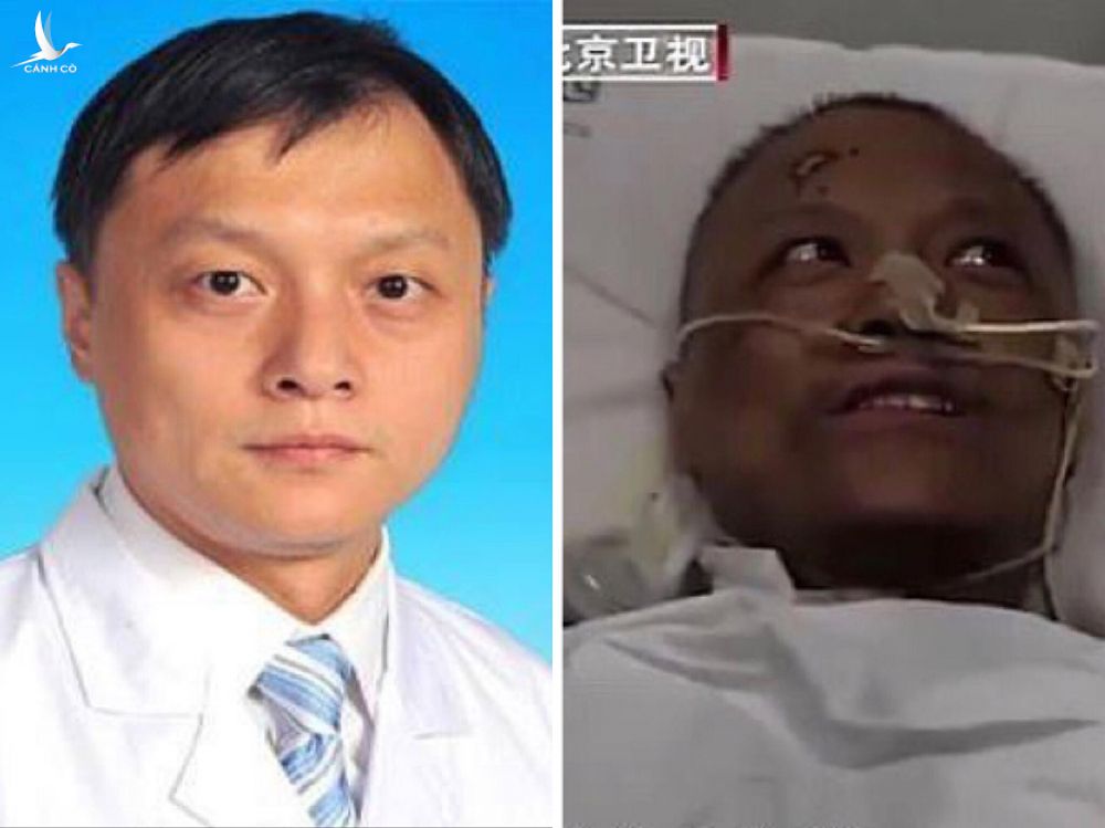 Bác sĩ Yi trước và sau khi nhiễm nCoV. Ảnh: Wuhan Central Hospital, Beịing Satellite TV