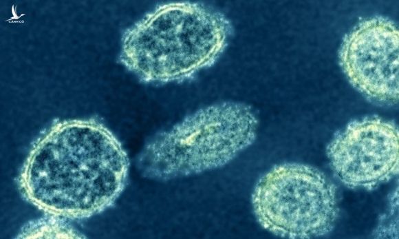 nguy cơ đại dịch mới virus H1N1 ảnh 1 nguy co dai dich moi virus H1N1 anh 1
