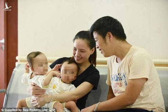 Báo Anh đưa tin bác sĩ Việt Nam tách thành công hai bé song sinh dính liền - Ảnh 1.