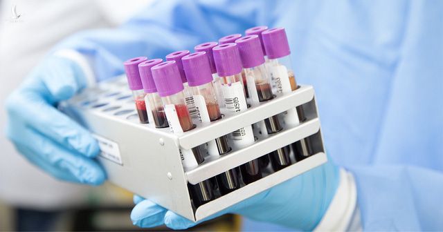 Phương pháp xét nghiệm máu phát hiện sớm 5 bệnh ung thư - Ảnh 1.