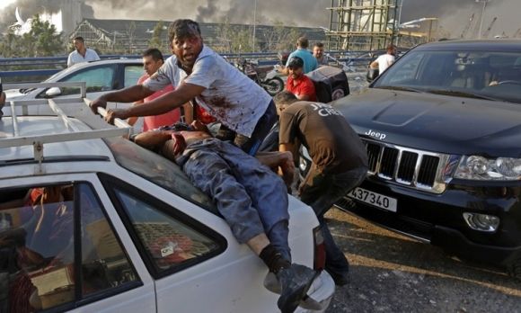 Người đàn ông bị thương nằm phía sau một chiếc ôtô trước khi được đưa khỏi hiện trường vụ nổ ở Beirut, Lebanon hôm 4/8. Ảnh: AFP.
