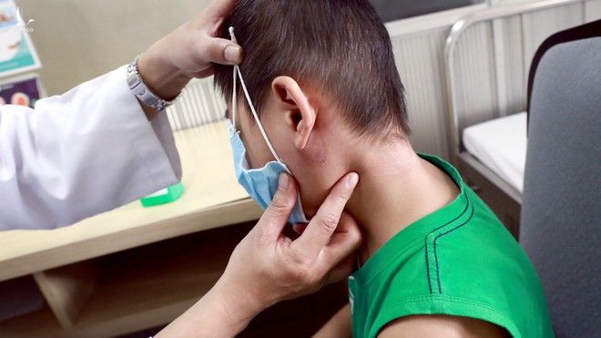 Bệnh nhi bị tuyến mang tai do vi khuẩn Burkhoderia Pseudomalei đang điều trị tại Trung tâm Nhi Bệnh viên T.Ư Huế /// Ảnh: BVCC