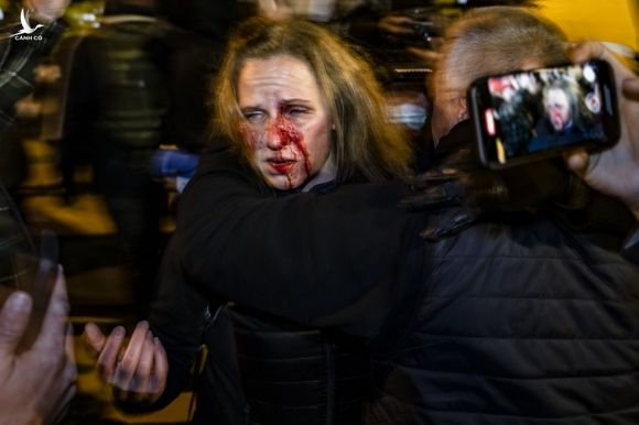 Một phụ nữ bị thương trong cuộc đụng độ giữa người biểu tình với cảnh sát ở phố Black Lives Matter Plaza tối 5/1. Ảnh: AFP.
