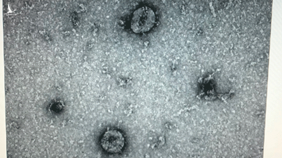 Virus SARS-CoV-2 có sức lây lan nhanh hơn tốc độ tiêm vắc xin Covid-19 /// ẢNH LIÊN CHÂU 