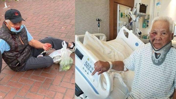 Ông Ngoc Pham (83 tuổi) là một trong hai người gốc Á bị tấn công tại San Francisco ngày 17.3
