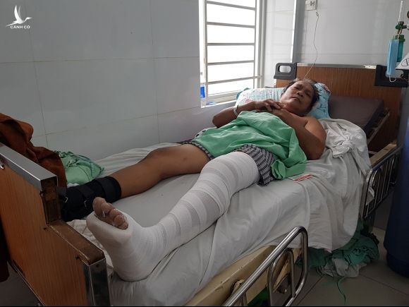 Ông Thuận được điều trị tại bệnh viện Chấn thương chỉnh hình, quận 5 sau khi nhảy xuống từ chung cư cháy, sáng 3/5. Ảnh: Đình Văn.