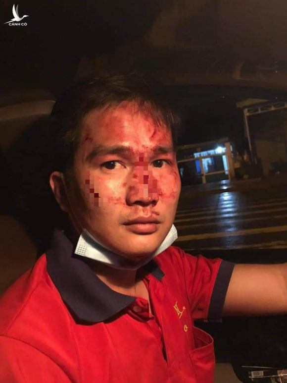 Điều tra vụ người đàn ông đánh tài xế taxi nhập viện, gây phẫn nộ trên mạng xã hội - Ảnh 1.