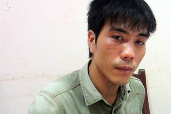Bệnh viện Tâm thần TW 1 bác thông tin bệnh nhân trốn viện điều hành đường dây bảo kê - Ảnh 1. Bệnh viện Tâm thần TW 1 bác thông tin bệnh nhân trốn viện điều hành đường dây bảo kê - Ảnh 1.