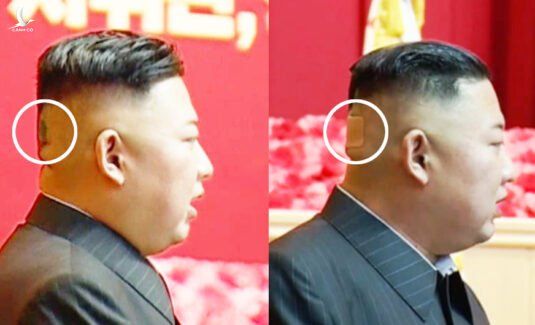 Ông Kim Jong-un bất ngờ xuất hiện với băng dán sau đầu - Ảnh 1.