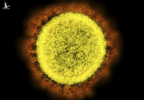 Virus corona mới nhìn từ kính hiển vi điện tử. Ảnh: Kyodo.