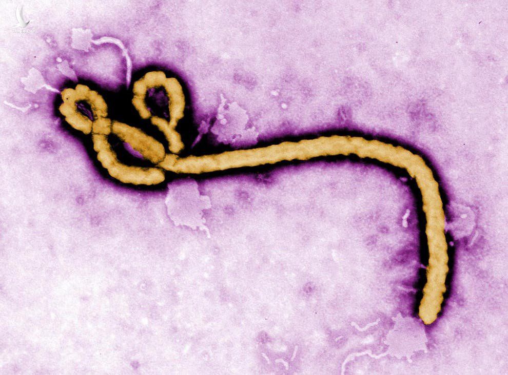 Virus Ebola anh 1