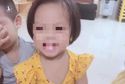 Tạm giữ người tình và mẹ bé gái 3 tuổi ở Hà Nội để điều tra hành vi bạo hành