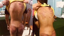 Thầy tu ở Bình Thuận khai nhận đánh đập bé trai 11 tuổi