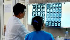 Lần đầu tiên ở Việt Nam có bệnh nhân xuất huyết não do… ngộ độc ma túy đá
