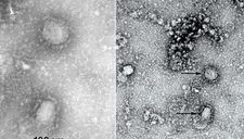 Trung Quốc công bố “chân dung” virus corona: Sự nguy hiểm chết người đằng sau tử thần nhỏ hơn cả bụi siêu mịn