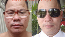 Hung thủ bắn thương vong 7 người ở Lạng Sơn đã chết do kiệt sức