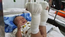 Con trai 4 tháng tuổi nghi bị cha ruột ‘chơi đá’ đánh đến xuất huyết não, gãy chân