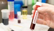 Nga bắt đầu thử nghiệm vaccine ngừa virus corona
