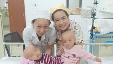 Báo Anh đưa tin bác sĩ Việt Nam tách thành công hai bé song sinh dính liền