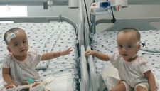 Song Nhi lần đầu chạm tay nhau sau ca mổ tách rời