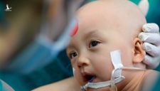 Một tháng mổ tách dính song Nhi, những đau đớn nhất đã qua