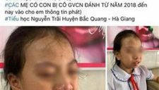 Tâm sự thật cô giáo tát học sinh lớp 4: “tôi đã phải kiềm chế rất nhiều”