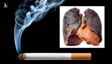 Người hút thuốc lá nếu mắc Covid-19 dễ tử vong hơn người không hút