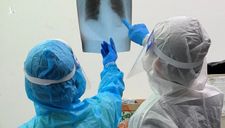 Chủ tịch Hội Truyền nhiễm VN lý giải nguyên nhân virus SARS-CoV-2 có thể gây tổn thương toàn bộ cơ thể