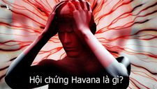 Hội chứng Havana – bí ẩn chưa lời đáp khiến CIA phải vào cuộc