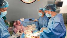 Sự thật bức ảnh 2 bé sinh đôi trong vụ bác sĩ rút máy thở