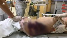 Tiết lộ bất ngờ từ hiệu trưởng về bé gái bị bạo hành tử vong