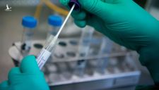 UBND TP HCM vừa có văn bản gửi Sở Y tế yêu cầu tăng cường kiểm tra kit test