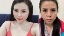 Hot girl Facebook Nabi Phương chuyên livestream bán “bột nho” trên nhóm kín sa lưới