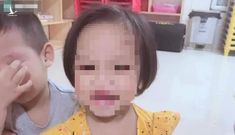 Sự thật về tin mẹ bé gái 3 tuổi nghi bị đinh bắn vào đầu “bị công an tạm giữ”