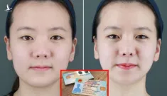Người phẫu thuật thẩm mỹ phải làm lại căn cước công dân, hộ chiếu