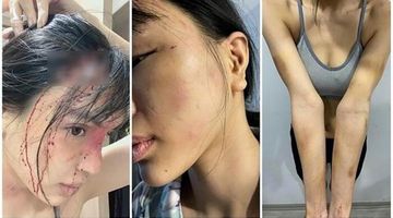 Điều tra vụ ‘siêu mẫu’ Khả Trang tố bị chồng chưa cưới hành hung, giam lỏng