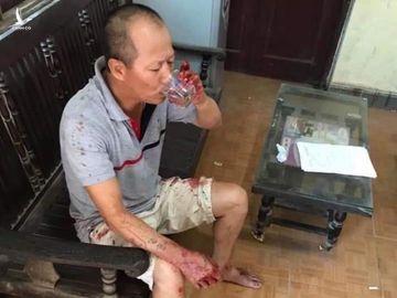 Ke tham sat gia dinh em trai binh tinh vao uong nuoc sau khi gay an hinh anh 1 