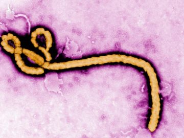 Nghe rất vô lý nhưng lại thuyết phục: Nhật Bản vừa nhập khẩu virus Ebola và 4 mầm bệnh sốt xuất huyết nguy hiểm nhất - Ảnh 1.